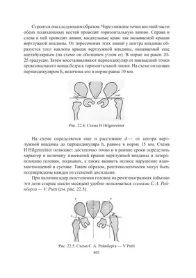 Кесарево сечение: показания, как делают, сколько длится