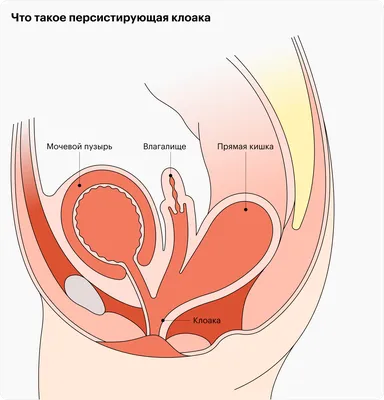 Гранулема пупка - Вопрос детскому хирургу - 03 Онлайн