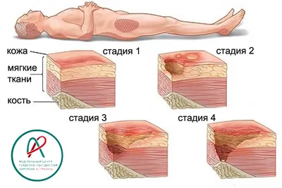 Как быстро заживить рану в домашних условиях: советы и методы - FitoBlog