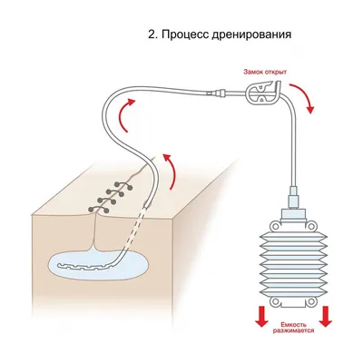 Дифференцированный подход к лечению ран кожи | ВКонтакте