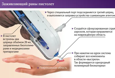 RU2367417C2 - Композит для лечения огнестрельных ран и способ лечения  огнестрельных ран - Google Patents