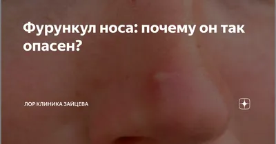 Чем опасен фурункул в носу?