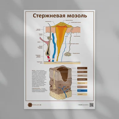 Центр здоровья ног / Натоптыши и \"шипицы\"