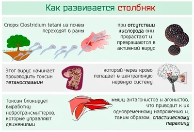 Столбняк - симптомы и лечение болезни | Здоровье