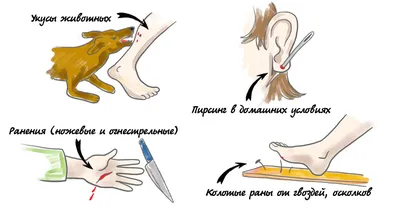 Столбняк: причины заражения, профилактика и лечение Советы врача