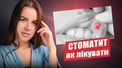 Стоматит фотографии ➡️ Возможно ли лечение по фото?