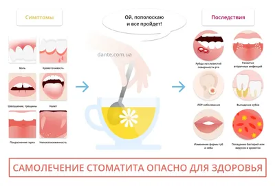Рецидивирующий хронический стоматит лечение у взрослых, эффективные  препараты