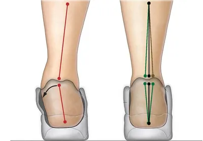 Боль в стопе: причины, лечение, профилактика | РБК Стиль