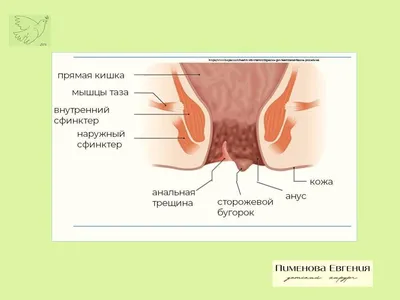 Обоснование состава геля изосорбита динитрата для лечения хронической  анальной трещины – тема научной статьи по фундаментальной медицине читайте  бесплатно текст научно-исследовательской работы в электронной библиотеке  КиберЛенинка