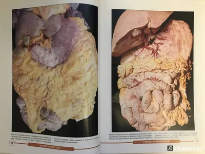 Анатомия человека. Строение и расположение внутренних органов человека.  Органы грудной клетки, брюшной полости, органов мало… | Анатомия человека,  Анатомия, Человек