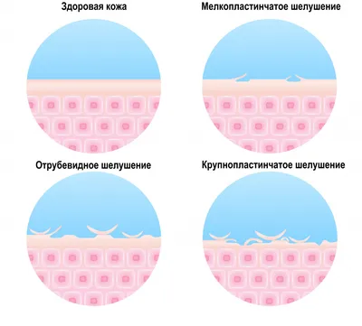 Сухие пятнышки на теле: причины, симптомы и методы лечения