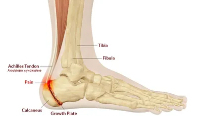 Сухожилия на ноге фото