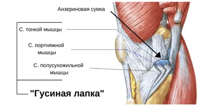 Тендинит связки надколенника — Травмаорто