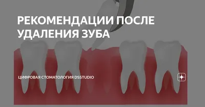 ᐈ Синяк после обезболивания зуба: причины появления, чем опасен, как лечить