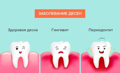 Свищ на десне у ребенка — причины и лечение на Startsmile.ru