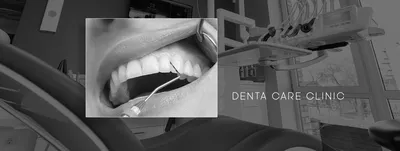 Свищ на десне - что это такое, от чего появляется и как его вылечить -  Denta Care Clinic