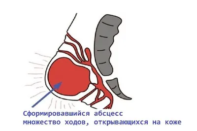 Парапроктит, французский Король-Солнце и британский гимн. | Семейная Бьюти  | Дзен