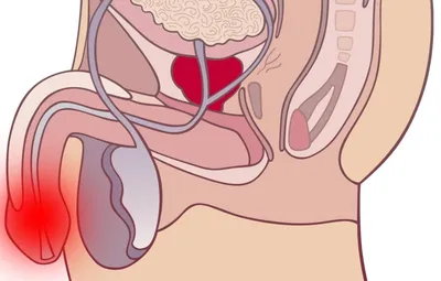 Зуд пениса: почему появляется зуд на половом члене | Частная практика