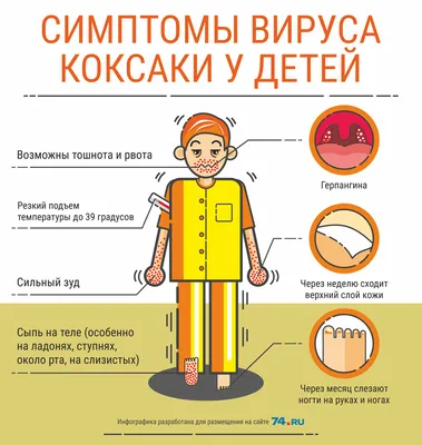 О заражении ВИЧ говорит определенная сыпь на коже » Сетевое издание  «Соловей.Инфо»