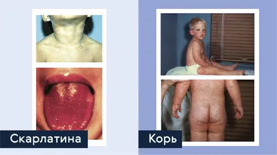 Красные пятна на теле | причины появления пятен на коже, лечение,  диагностика и профилактика