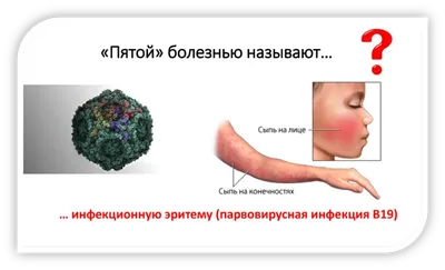 Гепатит С у женщин - описание, лечение, беременность