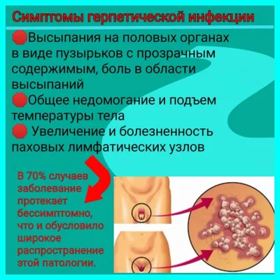 В Югре стартовала Неделя борьбы со СПИДом и информирования о венерических  заболеваниях. Департамент здравоохранения Югры информирует | 28.11.2023 |  Ханты-Мансийск - БезФормата