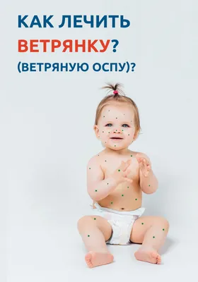 Ветряная оспа