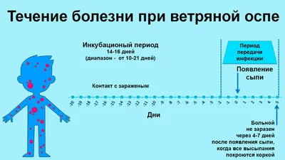 Ветрянка, симптомы, течение заболевания, осложнения, лечение.