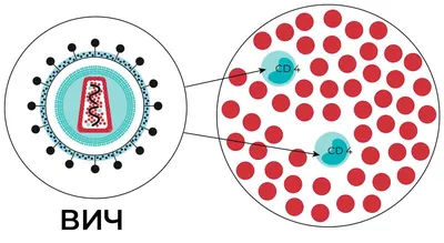 ВИЧ-инфекция: причины, диагностика, лечение