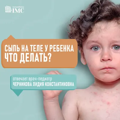 Инфекционная эритема (Erythema infectiosum)