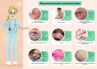 Высыпания на лице у грудничка — 6 ответов | форум Babyblog