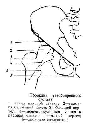 Тазобедренный сустав | Hip | ortoped-klinik.com