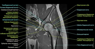 Анатомия тазобедренного сустава: МРТ-изображения (3 Тл) и трёхмерные  иллюстрации | e-Anatomy