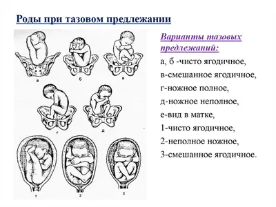 Таз... - Научный центр акушерства, гинекологии и перинатологии | פייסבוק