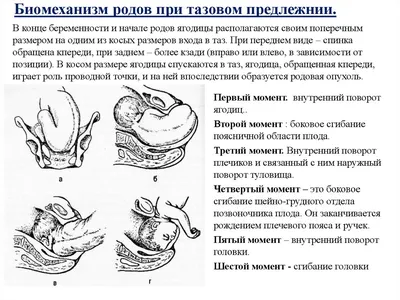 Что такое тазовое предлежание плода | krohi pro | Дзен