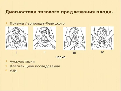 Двойни, задержка роста плода, тазовое предлежание: как улучшить исходы? –  тема научной статьи по клинической медицине читайте бесплатно текст  научно-исследовательской работы в электронной библиотеке КиберЛенинка