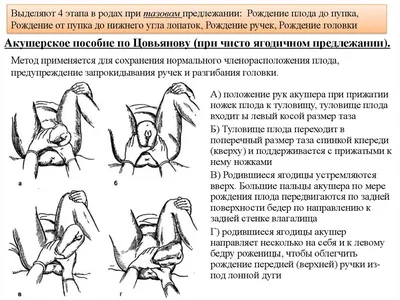 ЖЕНСКИЙ ЦЕНТР ЗДОРОВЬЯ on Instagram: \"💞💞💞 Тазовое предлежание - вариант  расположения плода в матке, при котором его тазовый конец предлежит к входу  в малый таз женщины. 💞💞💞 Клиническая классификация: 💞💞💞 1.✓ Чисто