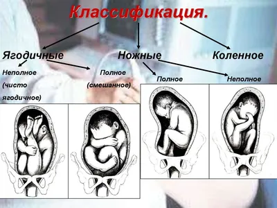 Низкая плацента при беременности: чем опасна и как рожать - статья  репродуктивного центра «За Рождение»