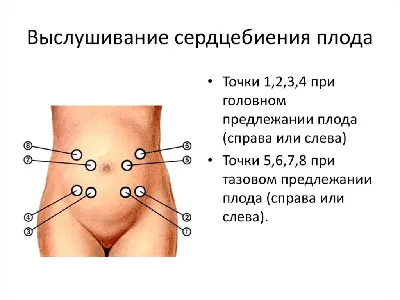 Тазовое предлежание плода - причины, особенности течения беременности, -  презентация, доклад, проект