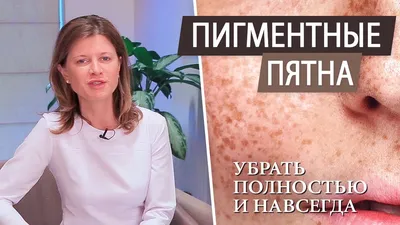 Дерматолог рассказала, симптомом какого заболевания являются темные пятна  на коже