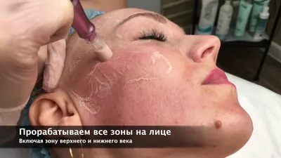 Что лучше, кислотный тоник Pixi Beauty или тиогамма? Всегда ли Айхерб  дешевле аптеки?