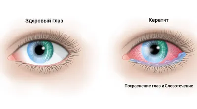 Кожные Проявления Опухолей- Консультация Дерматолога