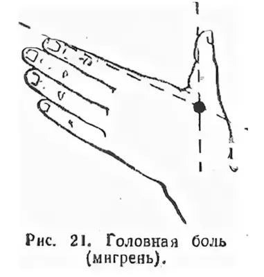 Головная Боль - Диагностика и Лечение головной боли в Киеве ✔️