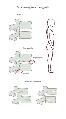 Точки от головной боли | Китайская медицина 21 века от Шубоши4.ру