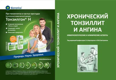 Хронический тонзиллит или болезнь, которой нет | Клиника Рассвет