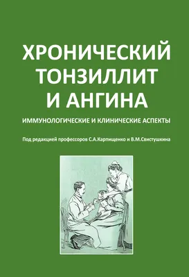 Ангина - ЛОР в Самаре - врач Лунёв Андрей Владимирович