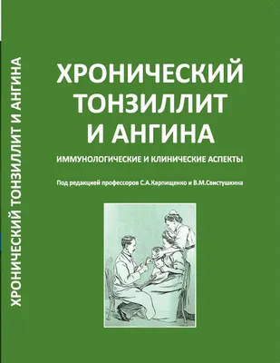 Хронический тонзиллит лечение симптомы, как лечить хронический тонзиллит -  блог Furasol®