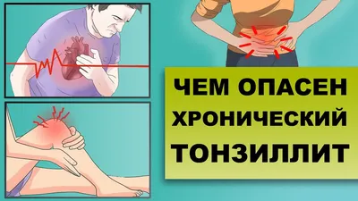 Купить препараты для лечения тонзиллита от компании МейТан