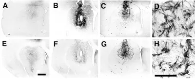 Vesicular Monoamine Transporter-2 and Aromaticl-Amino Acid Decarboxylase  Enhance Dopamine Delivery afterl-3,4-Dihydroxyphenylalanine Administration  in Parkinsonian Rats | Journal of Neuroscience