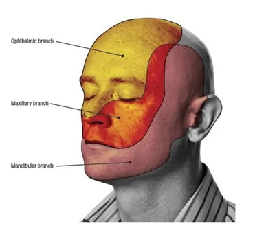 Невралгия тройничного нерва: симптомы, лечение в Херсоне | Neuro.ks.ua.